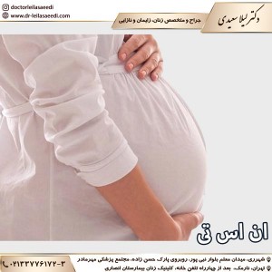 ان اس تی