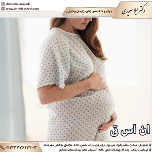 ان اس تی