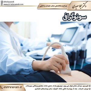سونوگرافی