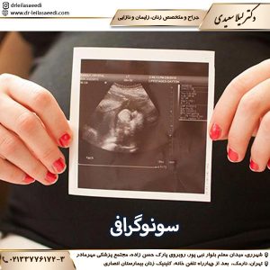 سونوگرافی