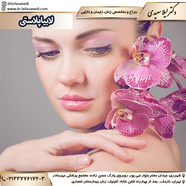 لابیاپلاستی