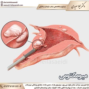 میومکتومی - دکتر سعیدی