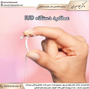 گذاشتن آی یو دی