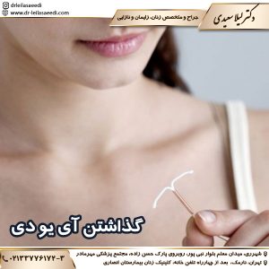 گذاشتن آی یو دی