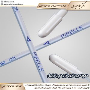 نمونه برداری از رحم با پایپل