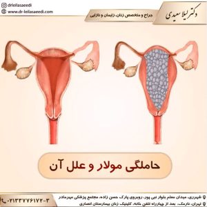 حاملگی مولار