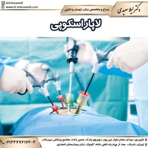 لاپاراسکوپی