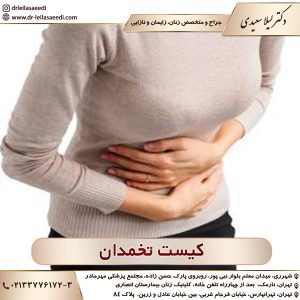 کیست تخمدان