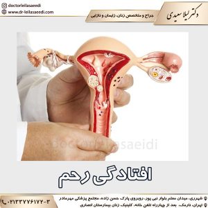 افتادگی رحم
