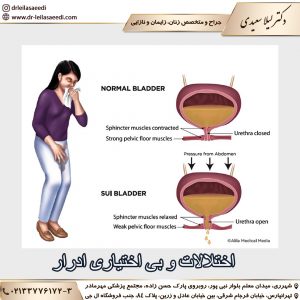 اختلالات و بی اختیاری ادرار